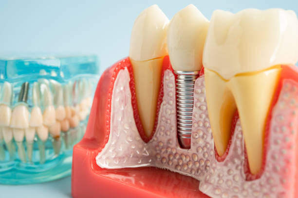 Best Dental Fillings (Composite and Amalgam)  in Novi, MI